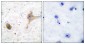 GABA-B Receptor Antibody